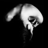 Slipped Disc, Bulging Disc or Herniated Disc Treatment Slipped Disc, Bulging Disc or Herniated Disc Treatment