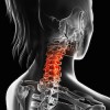 Degeneration Occurs When the Spine Doesn’t Move cervical-spine