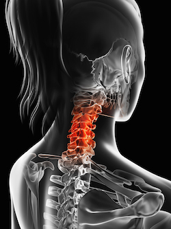 Degeneration Occurs When the Spine Doesn’t Move