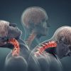 A 5MPH Crash is Enough to Cause Spinal Damage A 5MPH Crash is Enough to Cause Spinal Damage